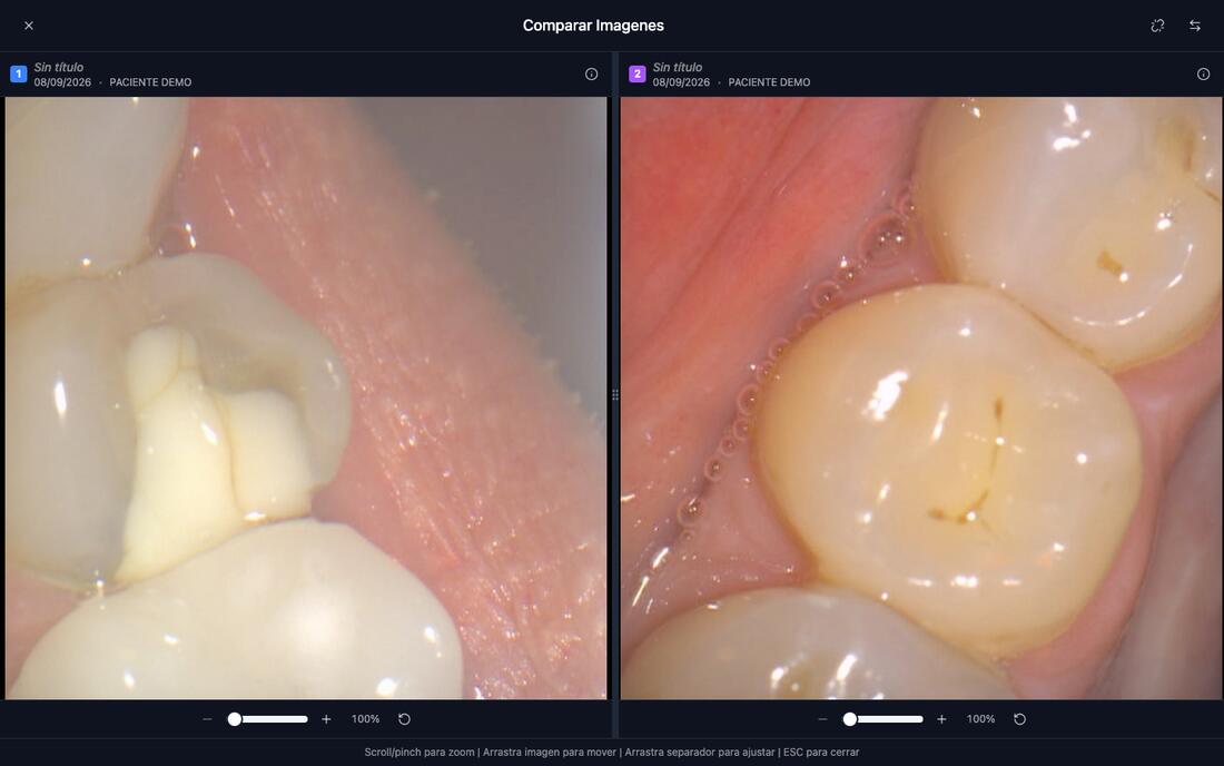 Comparador de dos fotos intraorales lado a lado