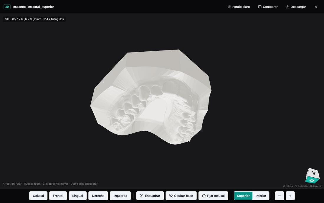 Visor 3D de NUXIA con un escaneo intraoral